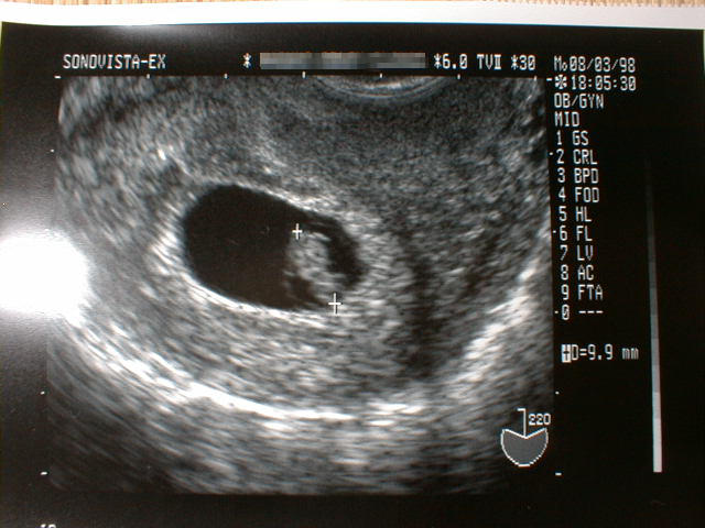 ch-1.jpg (57432 �o�C�g)