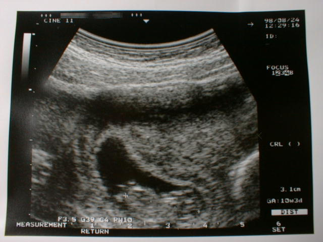 ch-2.jpg (47907 �o�C�g)