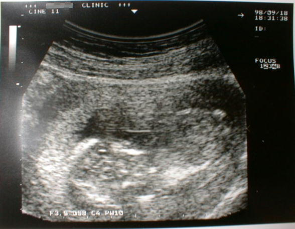 ch-3.jpg (45807 �o�C�g)