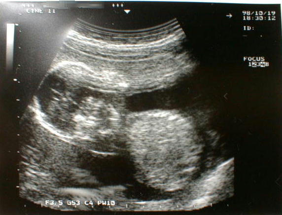 ch-4.jpg (45673 �o�C�g)