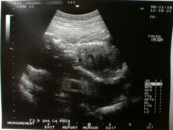 ch-5.jpg (40597 �o�C�g)